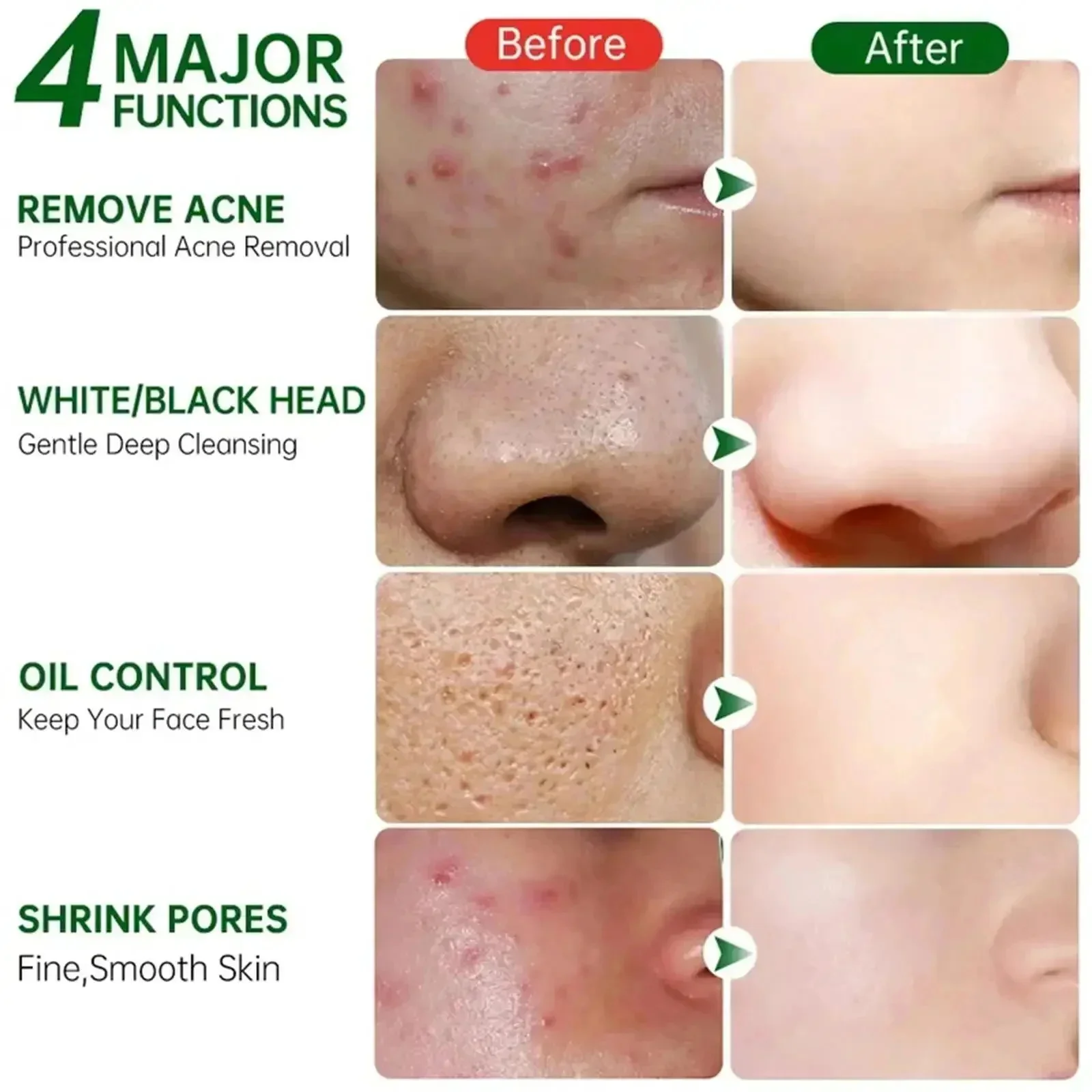 Salicylic Acid Pore Clearing C - Korean Skincare Routine recension och pris