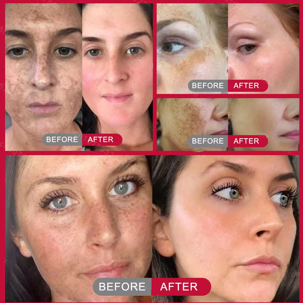 Powerful Spot-removing Whiteni - Korean Skincare Routine recension och pris